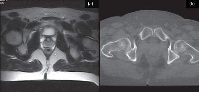 MR Sim imaging.